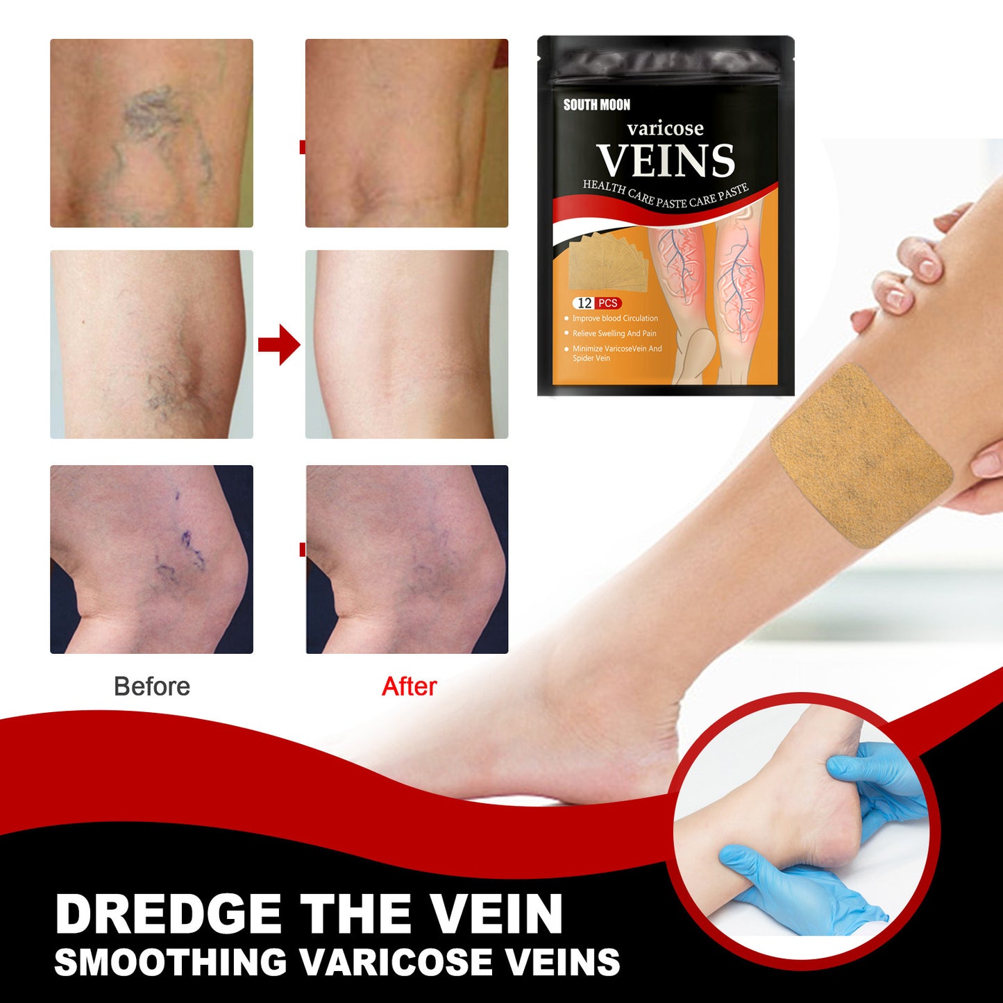 South Moon Varicose Vein Relief  Foot Patch